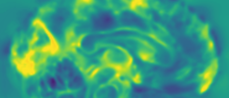 Functional Imaging | Neuroimaging - The University of Iowa