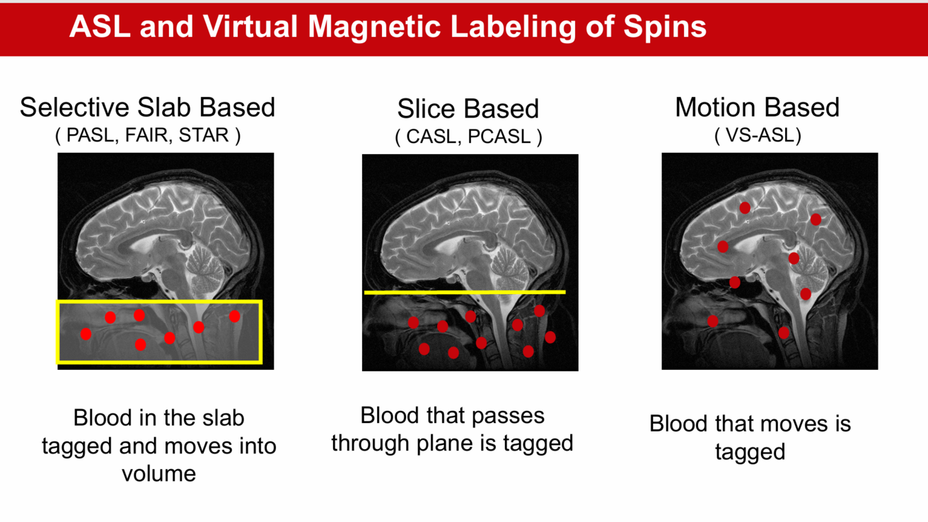 Different methods of ASL