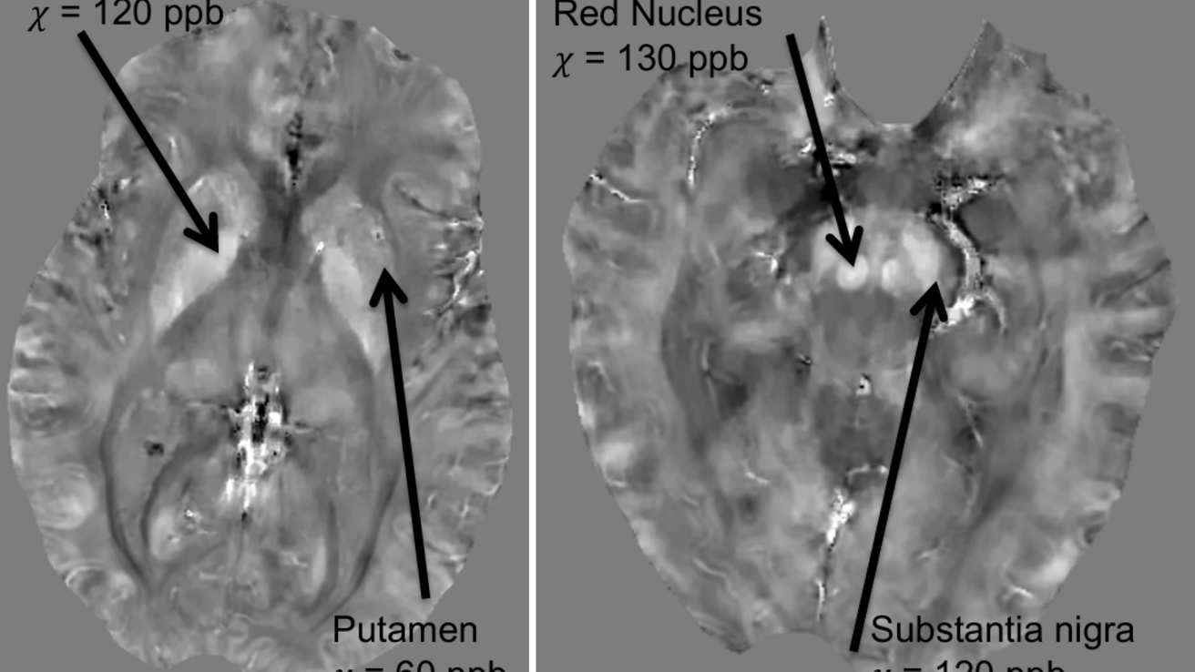 QSM images of axial brain slices